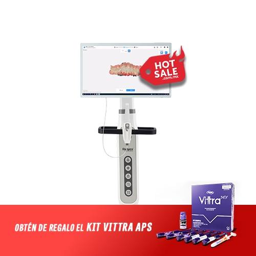 Escaner Intraoral 3DS Runyes iOS Station