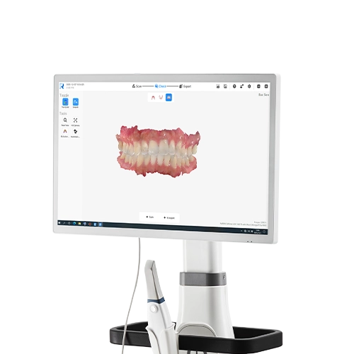 Escaner Intraoral 3DS Runyes iOS Station - Image 2