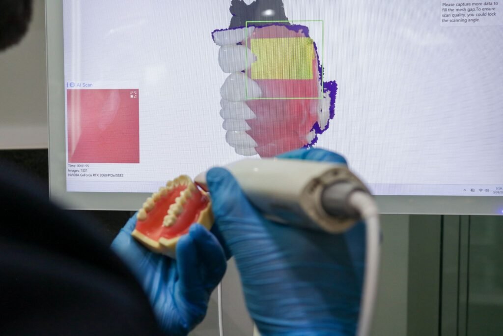 Escáner intraoral 3DS V5 Runyes